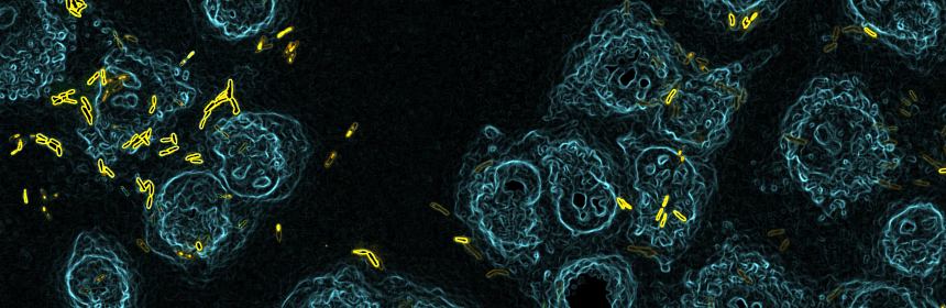 Lung cells infection by Pseudomonas aeruginosa